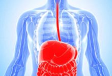 Barrett’s Disease causes, symptoms and remedies