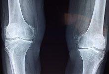 Better Bone Health