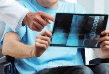 Orthopaedic conditions treatment in Indore