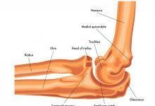 Radius and Ulna Mechanism of Injury