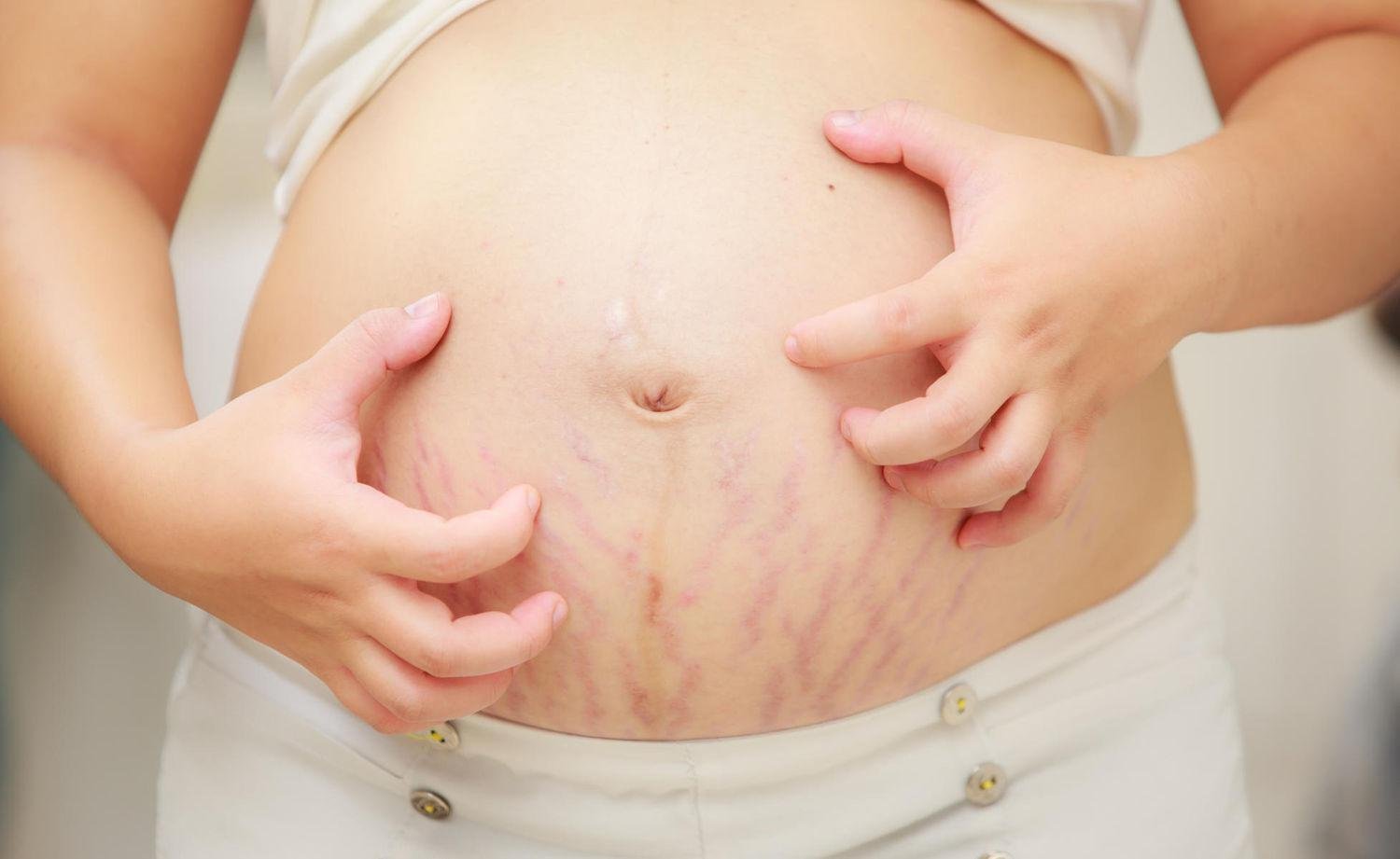 Overcoming Pain and Discomfort during the Stage of Pregnancy