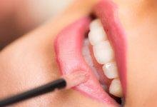 Dental