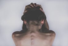 Finasteride