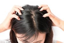 Rid of Dandruff